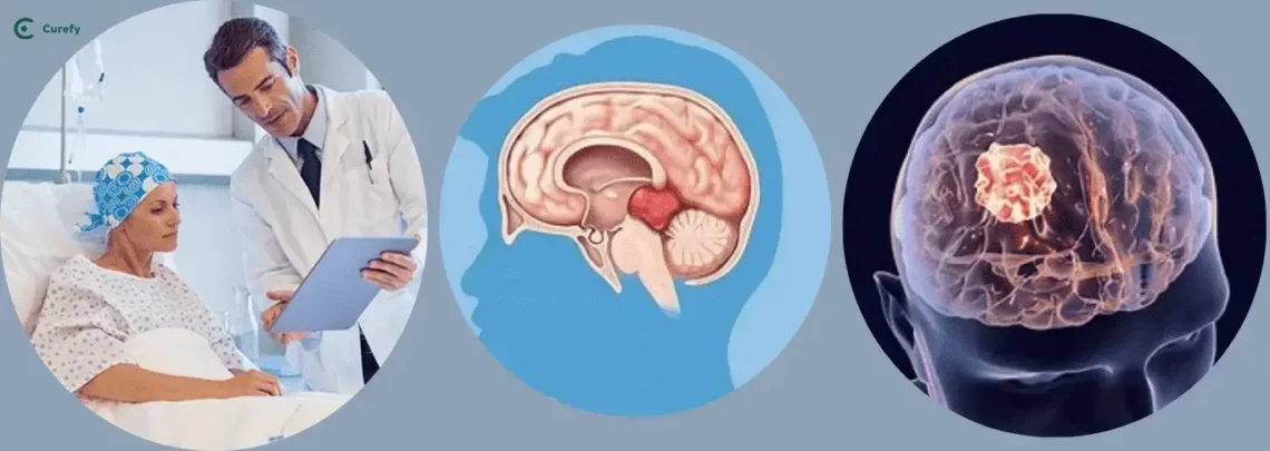 Top 10 Pituitary Tumor Surgeons in India